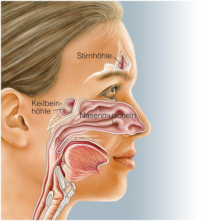 chronische sinusitis heilen Nasennebenhöhlen Anatomie Frau